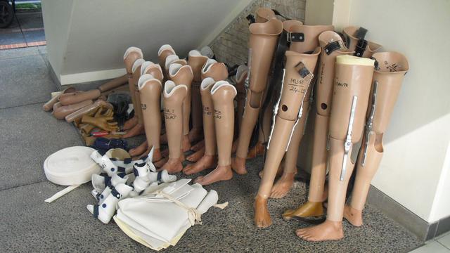 Bantuan Kaki dan Tangan Palsu