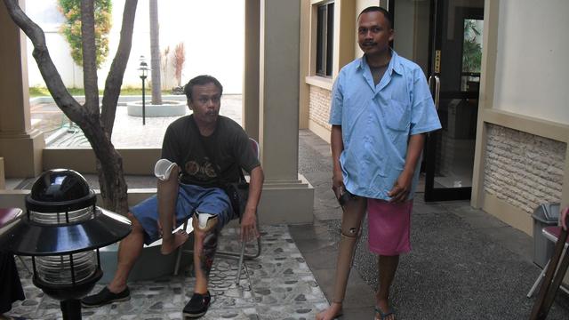 Bantuan Kaki dan Tangan Palsu