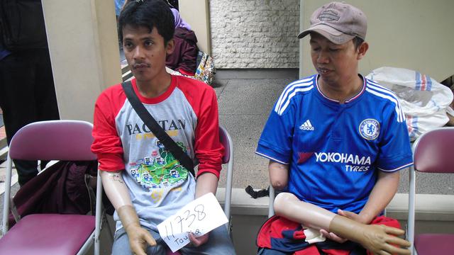 Bantuan Kaki dan Tangan Palsu
