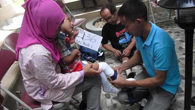 Bantuan Kaki dan Tangan Palsu