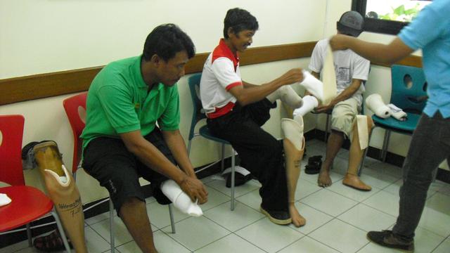 Bantuan Kaki dan Tangan Palsu